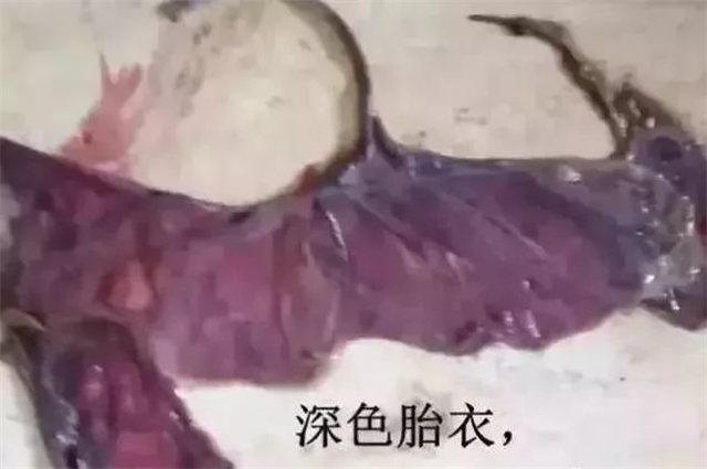 �ж�ĸ���Ƿ�����4������̥����ɫ